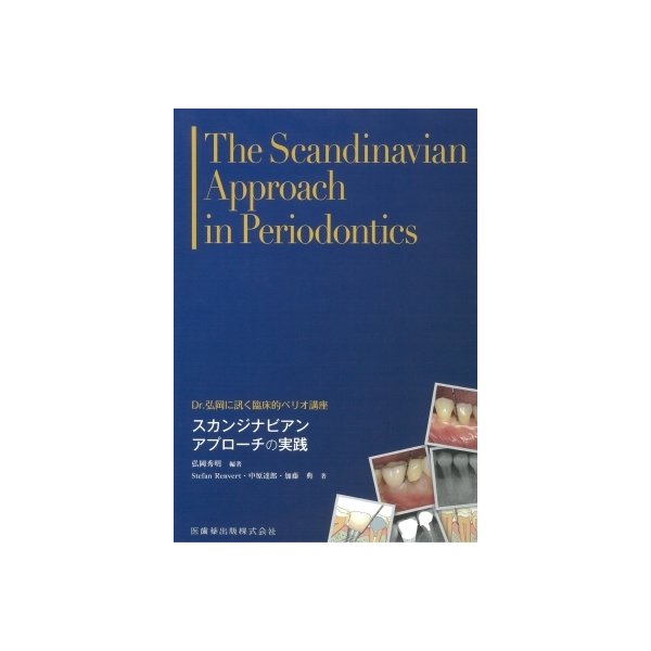 スカンジナビアンアプローチの実践 Dr.弘岡に訊く臨床的ペリオ講座