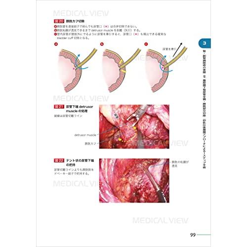 究める 腎・副腎腫瘍に対する腹腔鏡・ロボット支援手術