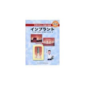 科学が生んだ歯の治療 インプラント