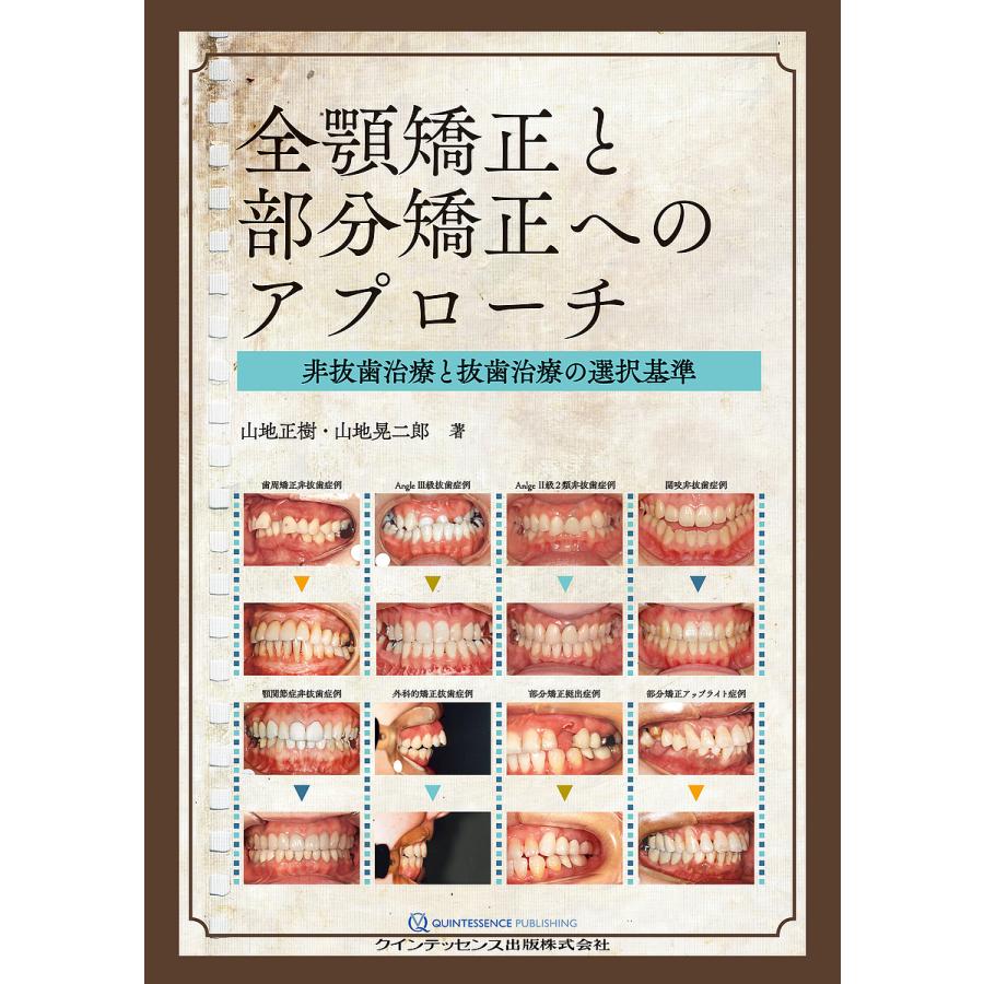 全顎矯正と部分矯正へのアプローチ