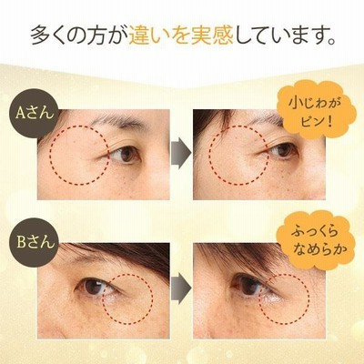 シワ対策クリーム➕ビタミンC 楽天市場】BIOAQUA ビタミンCアイクリーム まぶた たるみ 目の下