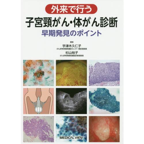 外来で行う子宮頸がん・体がん診断 早期発見のポイント