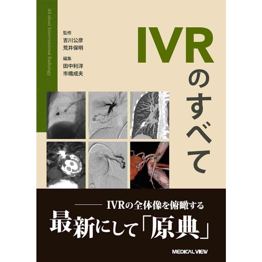 IVRのすべて