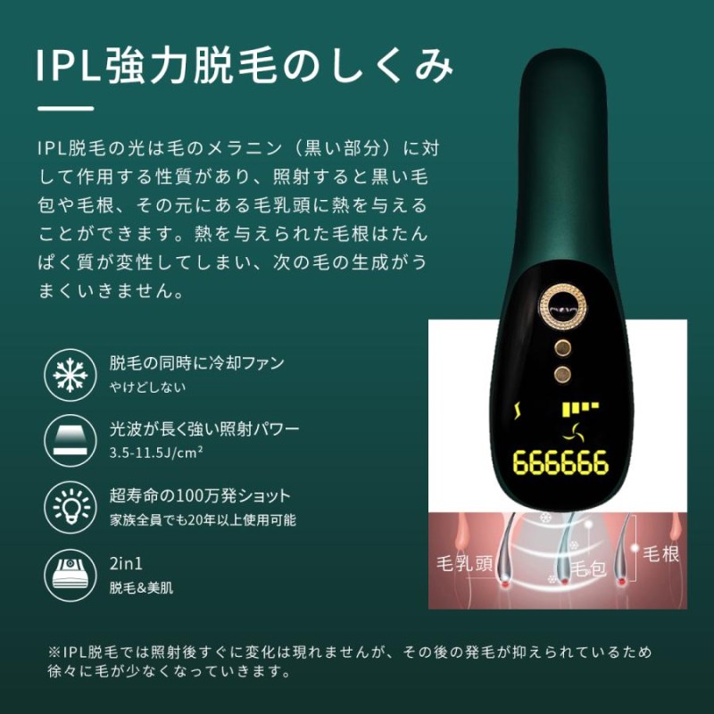 脱毛器 IPL光脱器 永久脱毛 家庭用脱毛器 自動照射 レーザー vio