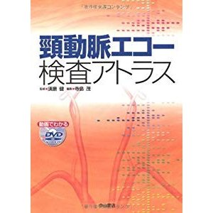 頸動脈エコー検査アトラス