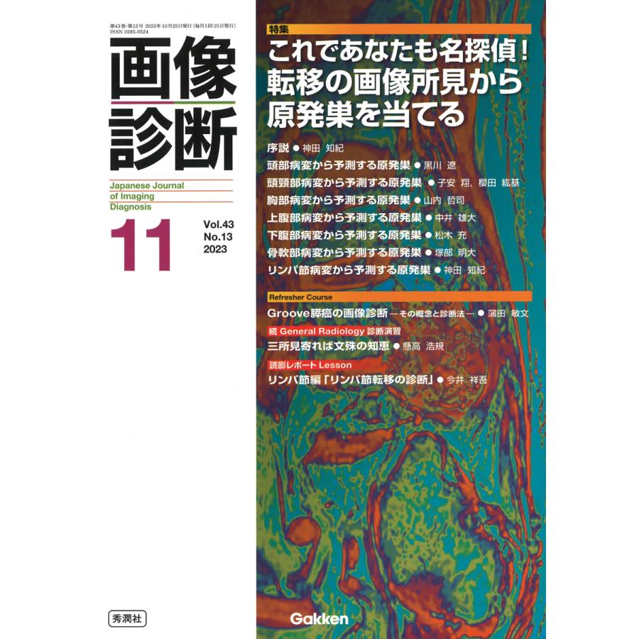 画像診断 Vol.43No.13