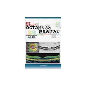 身につくOCTの撮り方と所見の読み方 大谷倫裕