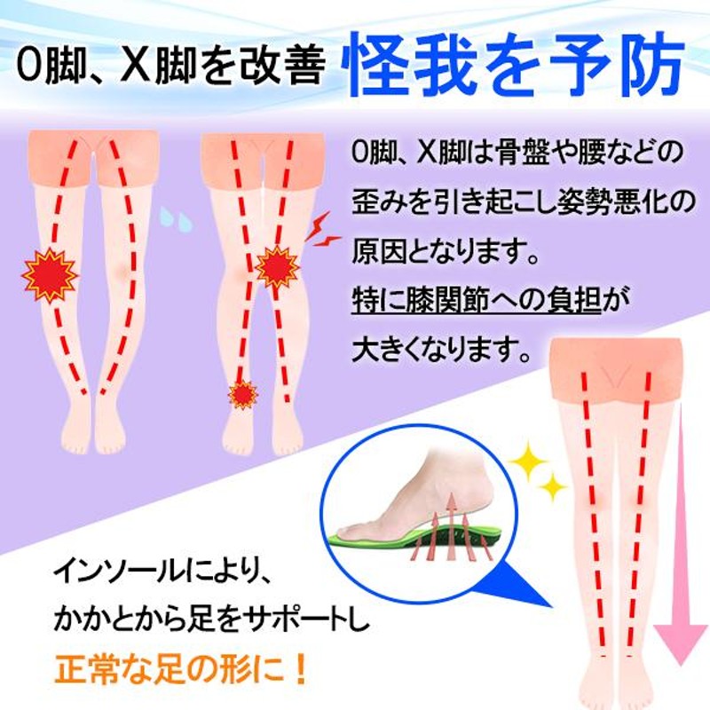 大特価❣️アーチサポート インソール 足底筋膜炎 中敷き 偏平足 X脚矯 通販
