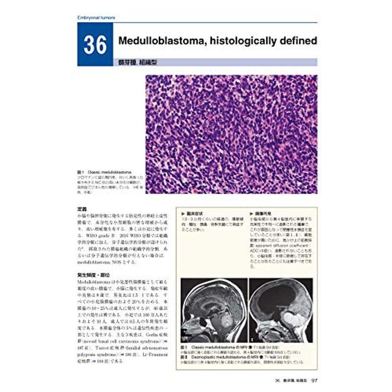 脳腫瘍臨床病理カラーアトラス 第4版