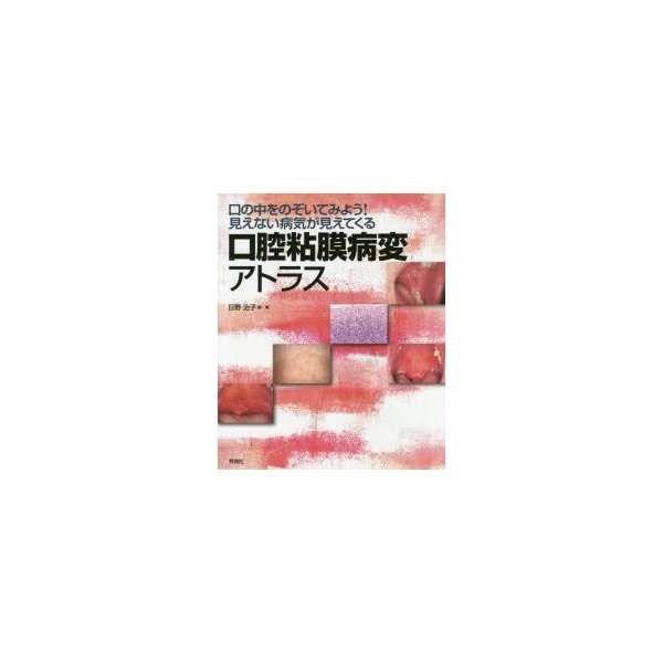 口腔粘膜病変アトラス 口の中をのぞいてみよう 見えない病気が見えてくる