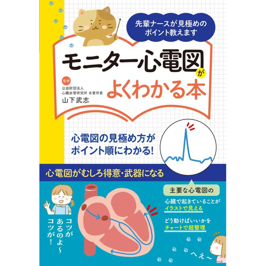 モニター心電図がよくわかる本 先輩ナースが見極めのポイント教えます