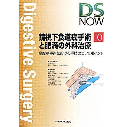 鏡視下食道癌手術と肥満の外科治療 高度な手術における手技のコツとポイント Ｄｉｇｅｓｔｉｖｅ　Ｓｕｒｇｅｒｙ　ＮＯＷＮｏ．１０／上西