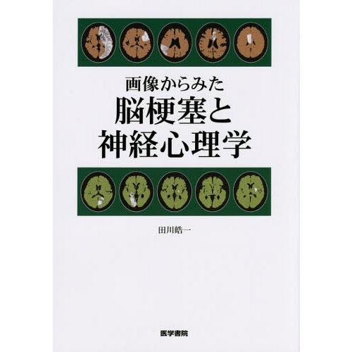 画像からみた脳梗塞と神経心理学