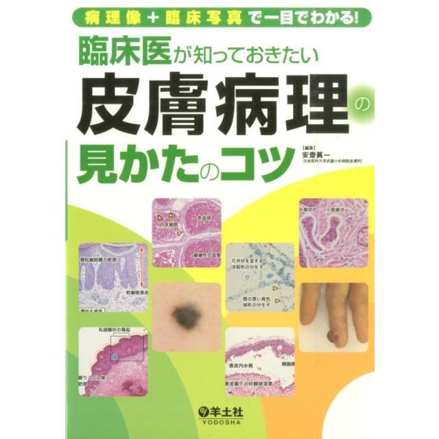 病理像 臨床写真で一目でわかる 臨床医が知っておきたい皮膚病理の見かたのコツ