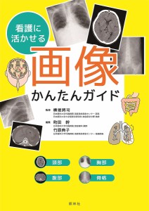 看護に活かせる画像かんたんガイド 横堀將司 町田幹 竹原典子