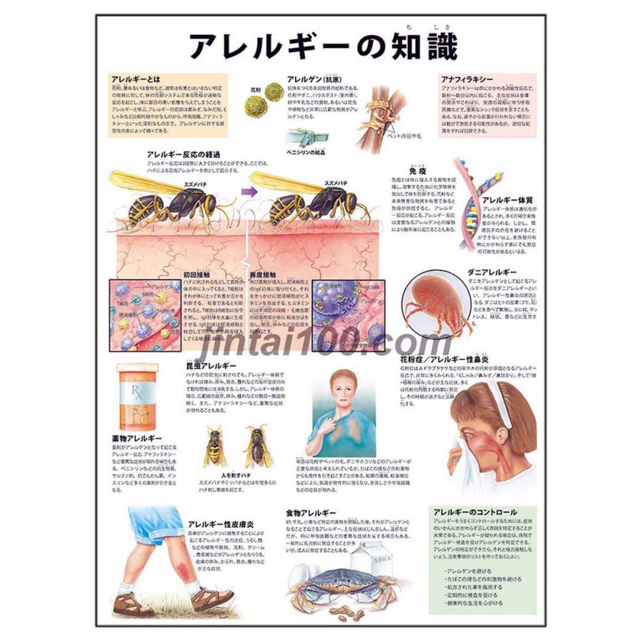 アレルゲン オファー ポスター