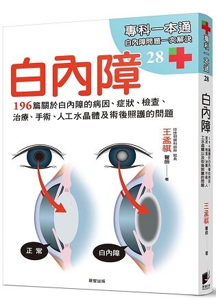 白內障：196篇關於白內障的病因、症狀、檢查、治療、手術、人工水晶體以及術後照護的問題