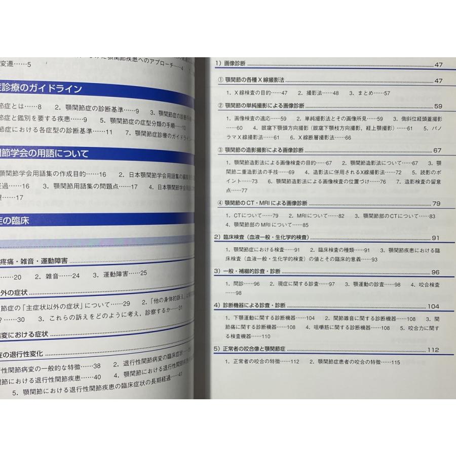 中古本　顎関節症　日本顎関節学会編　永末書店　歯科　医療　書籍　本　専門書