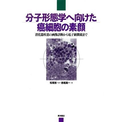 分子形態学へ向けた癌細胞の素顔 消化器疾患の画像診断から電子顕微鏡まで／赤尾周一(著者),松尾裕