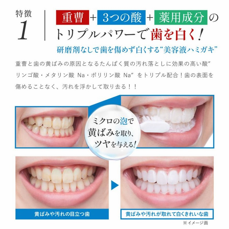ホワイトニング 歯磨き粉 セルフ 自宅 重曹 歯 白くする 歯周病 研磨剤なし 美白 口臭 虫歯 予防 無添加 黄ばみ 市販 薬用ホワイトニング デンタワン 通販 Lineポイント最大0 5 Get Lineショッピング