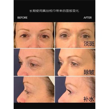 【溜溜推薦】HIGHHOLLY玻尿酸真絲枕套單人蛋白美容枕巾伴手禮物