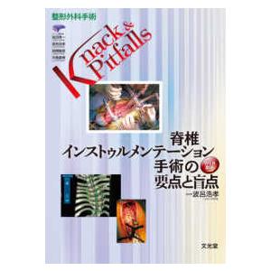 脊椎インストゥルメンテーション手術の要点と盲点