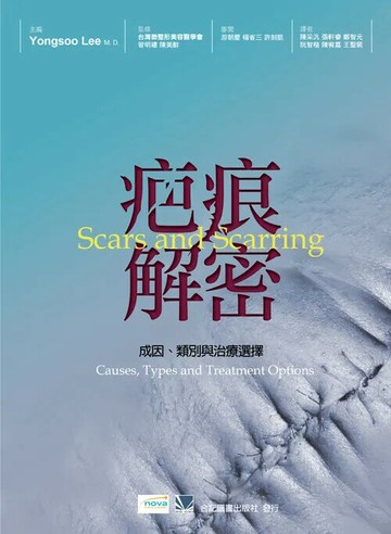 疤痕解密-成因、類別與治療選擇(Scars and Scarring: Causes, Types and Treatment Options)402-004C/9789863681779 (1版) *陳采汎  合記