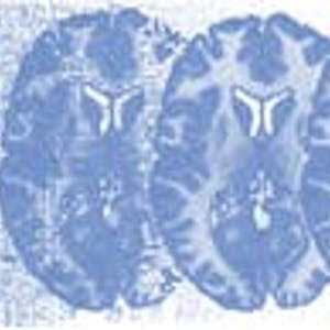 Neuroscience and Neuroimaging