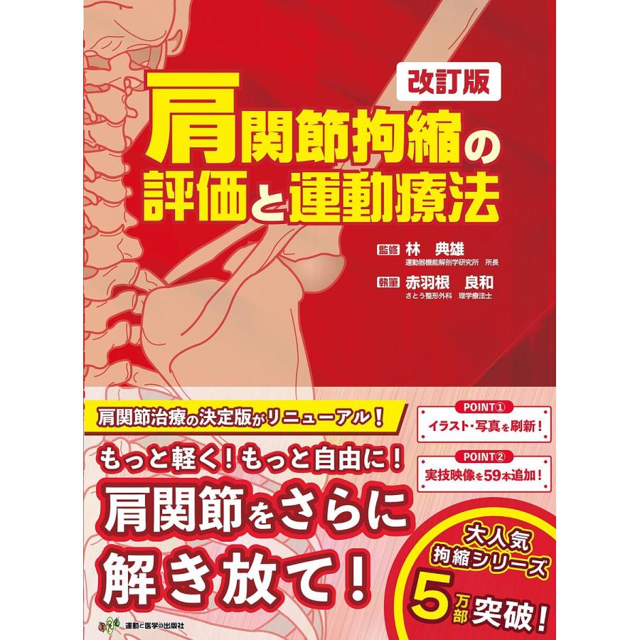 肩関節拘縮の評価と運動療法