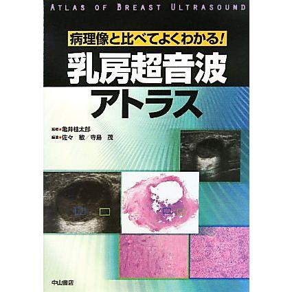 乳房超音波アトラス 病理像と比べてよくわかる