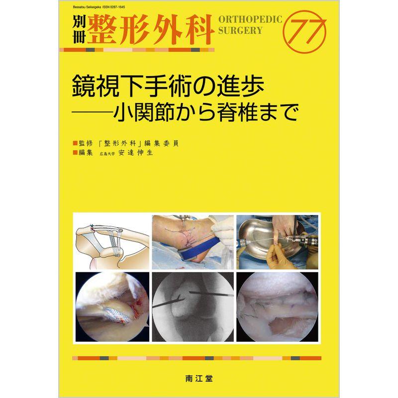 鏡視下手術の進歩: 小関節から脊椎まで (別冊整形外科)