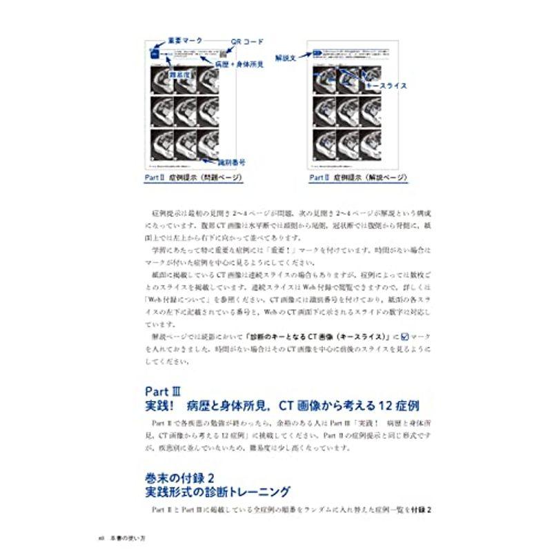 連続スライスで学ぶ レジデントのための急性腹症のCTWeb付録付