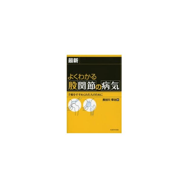 よくわかる股関節の病気 手術をすすめられた人のために