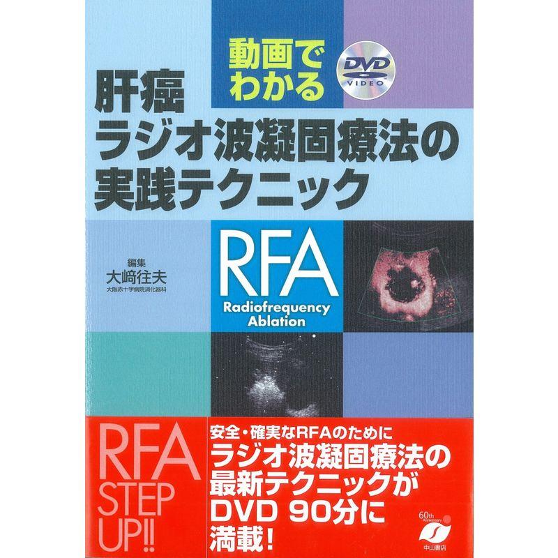 動画でわかる肝癌ラジオ波凝固療法の実践テクニック