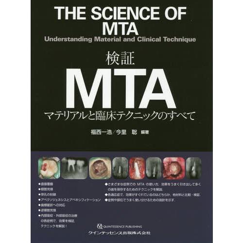 [本 雑誌] 検証MTA マテリアルと臨床テクニックのすべて 福西一浩 編著 今里聡 編著