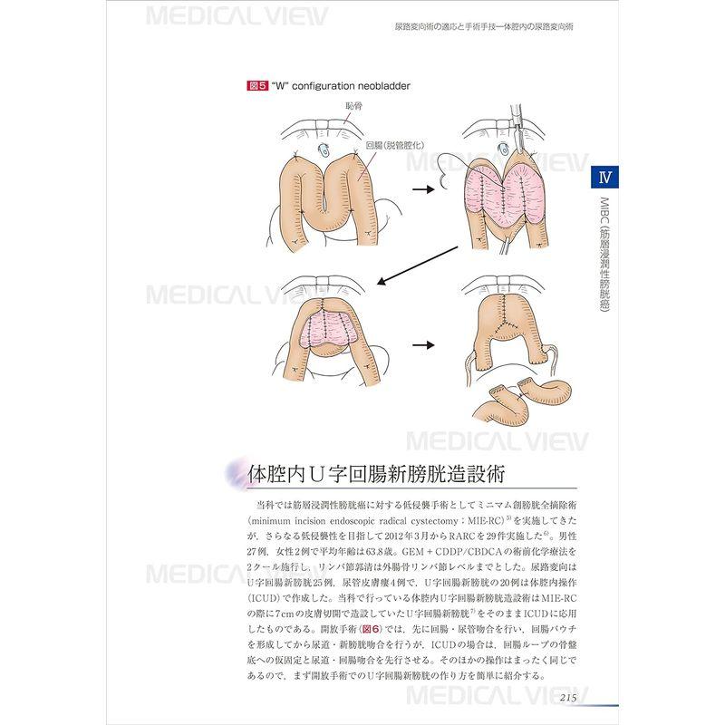 膀胱癌診療最前線