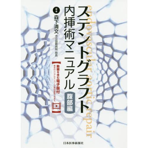 ステントグラフト内挿術マニュアル 腹部編 森下清文