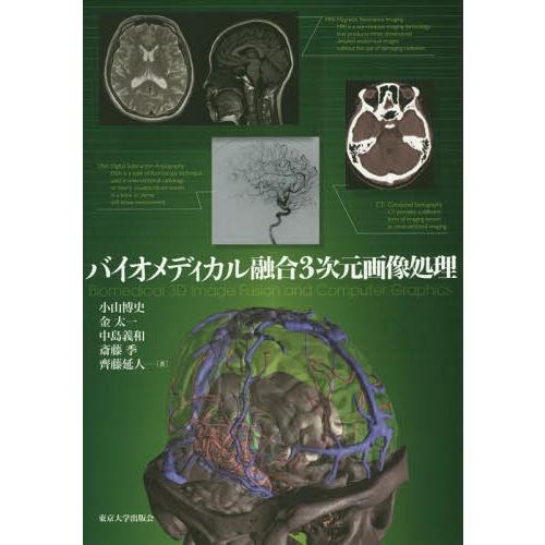 バイオメディカル融合3次元画像処理