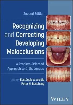 Recognizing and Correcting Developing Malocclusions: A Problem-Oriented Approach to Orthodontics (2版) Araujo 2025 John Wiley