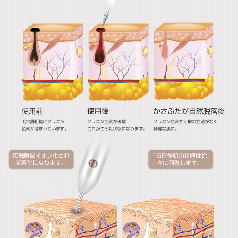 期間限定送料無料】 レーザーペン ほくろ 美顔器 ミニケア 2022最新技術 スポットペン 9階段調整 液晶ペン ライト付き セルフ 無痛感 美肌 美顔  美容 USB充電式 家庭用