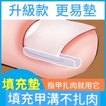 【桃園出貨】甲溝炎矯正神器 嵌甲 指甲填充墊片 隔離墊 正甲墊 糾正腳趾甲長到肉裏 RCH9