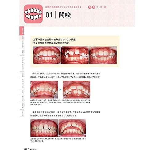 口腔習癖実践編 アイコンで見える化する口腔機能の問題点