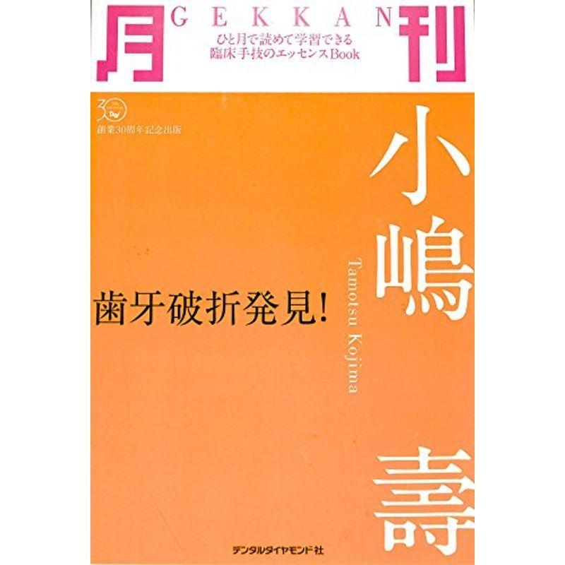 月刊小嶋寿?歯牙破折発見 (ひと月で読めて学習できる臨床手技のエッセンスBook)