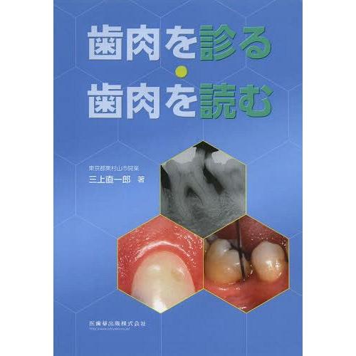 歯肉を診る・歯肉を読む