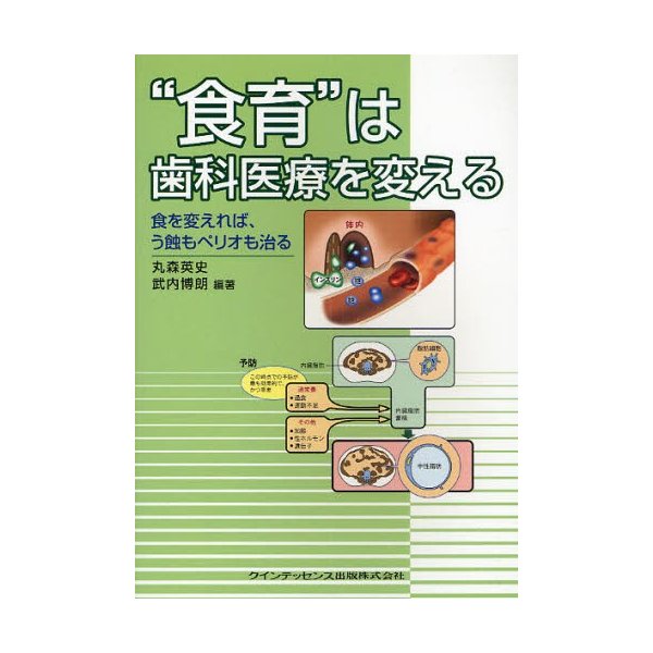 食育 は歯科医療を変える 食を変えれば,う蝕もペリオも治る