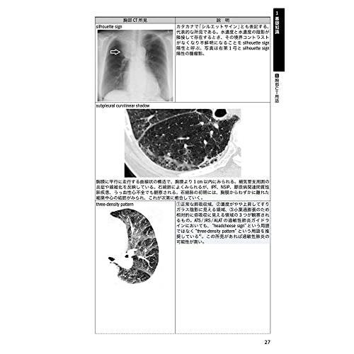 ポケット呼吸器診療2022