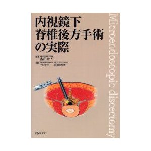 内視鏡下脊椎後方手術の実際