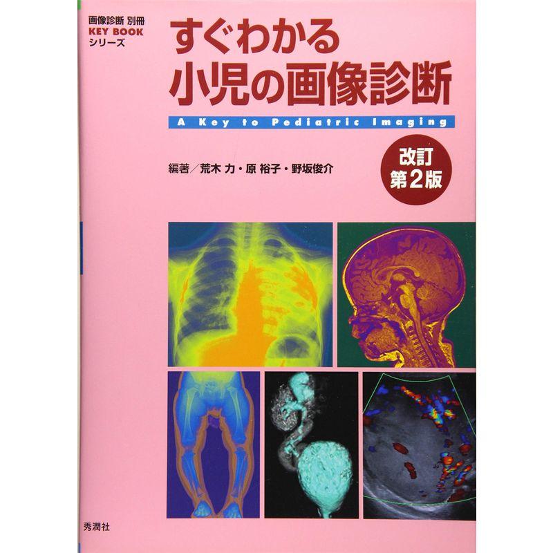 すぐわかる小児の画像診断 改訂第2版 (画像診断別冊KEYBOOKシリーズ)