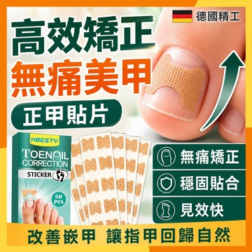 🔜現貨隔日達🔜德國正版正甲貼片 專業甲溝炎矯正神器 指甲長肉裏腳拉拉貼 嵌甲墊捲甲卷甲 修指甲剪刀 腳趾甲貼片美甲工具