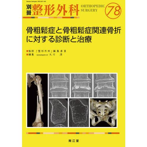 骨粗鬆症と骨粗鬆症関連骨折に対する診断と治療